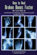 How to Heal Broken Bones Faster. Bone Fracture Healing Tips : Learn About Bone Fracture Healing Foods, Types of Bone Fractures, and the Five Stages of Bone Healing